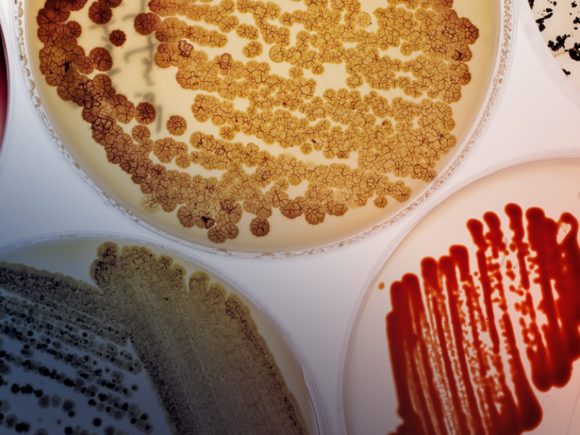 Close-up photograph of petri dishes with various bacteria and samples in red, yellow, brown, and orange